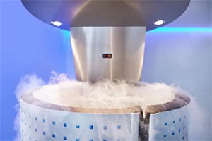 5 Cryotherapy Side Effects Therapists Should Watch For