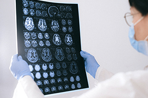 Heads Up: Understanding a Traumatic Brain Injury